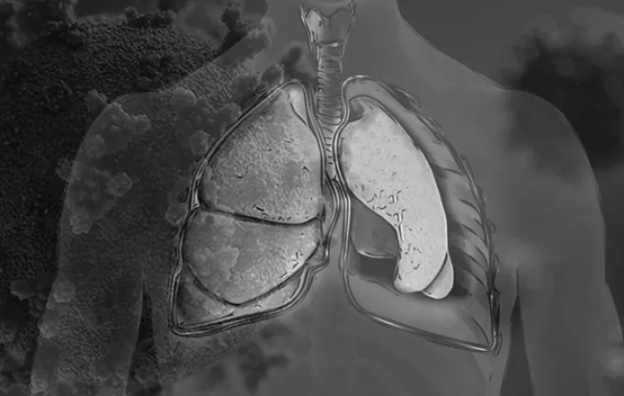 Sequelas pulmonares pós-covid podem progredir dois anos após a alta hospitalar (Jornal da USP)